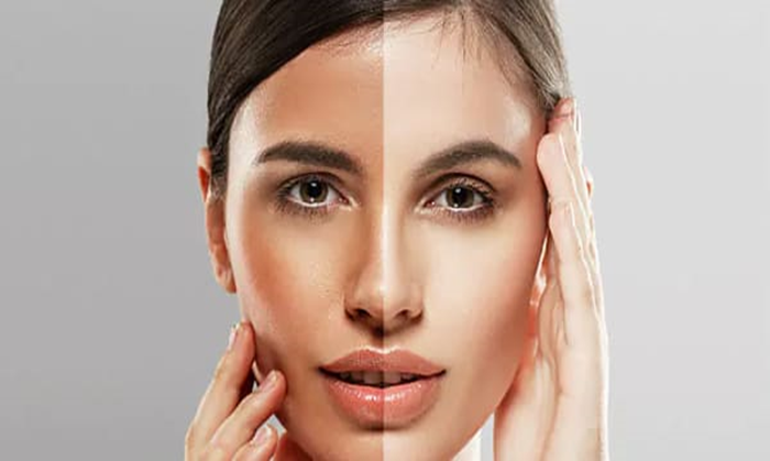 Facial Aesthetics