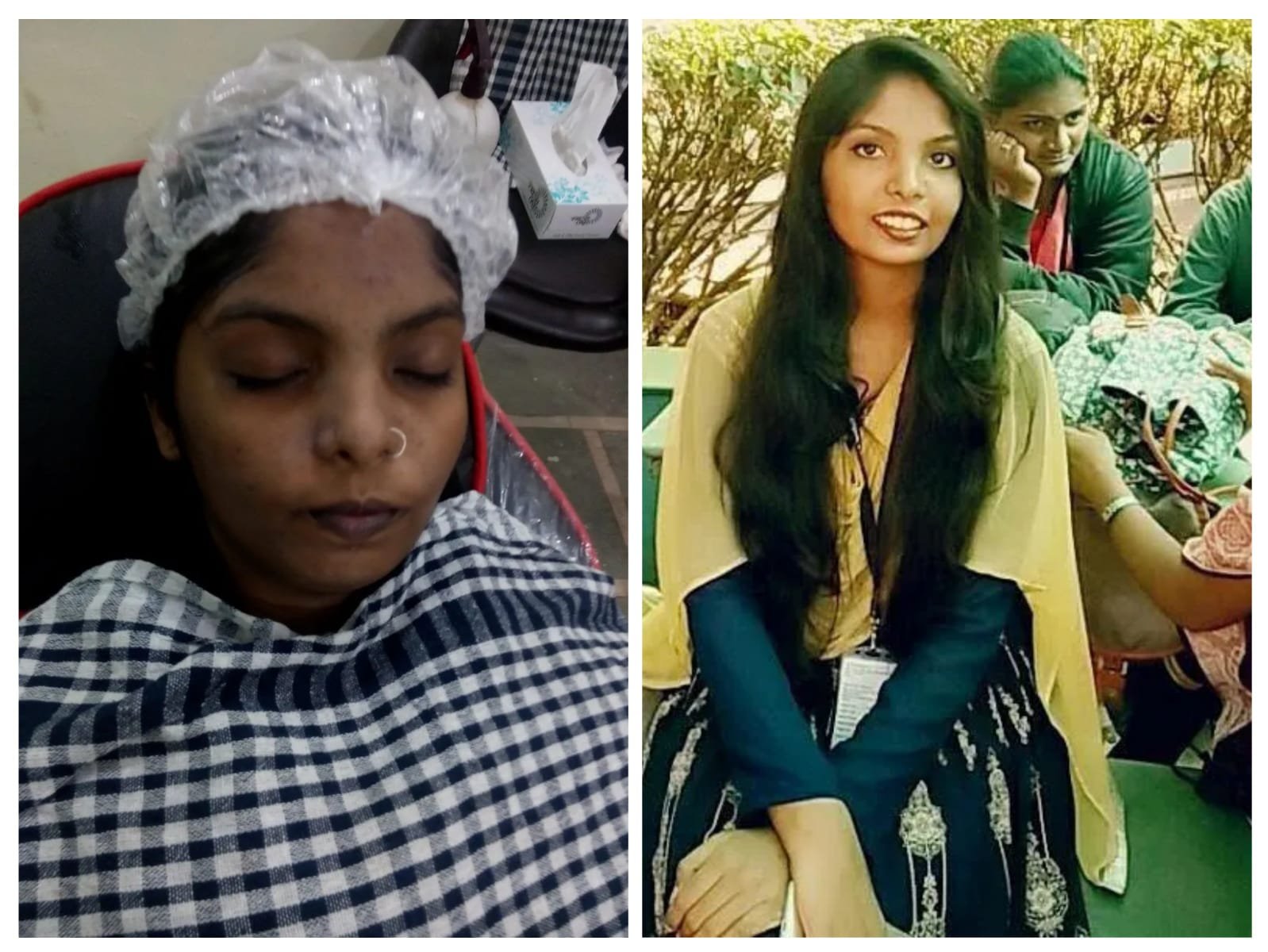 Skin Whitening Treatment